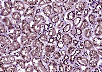 Histone H3 (acetyl K27) Rabbit Polyclonal Antibody