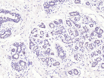 Histone H4 (tri methyl K20) Rabbit Polyclonal Antibody