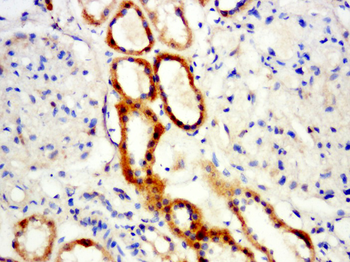 Hemoglobin subunit delta Rabbit Polyclonal Antibody