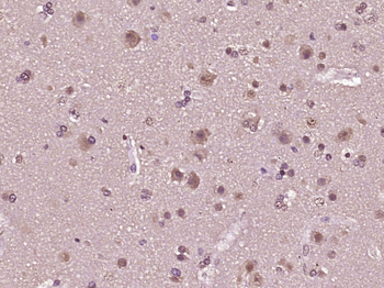 Phospho-HSF1 (Ser303 + Ser307) Rabbit Polyclonal Antibody