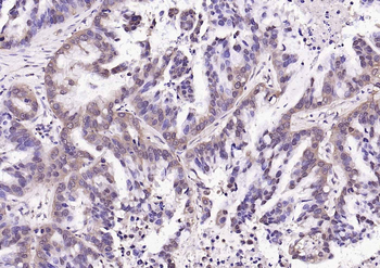 Phospho-HSF1 (Ser303 + Ser307) Rabbit Polyclonal Antibody