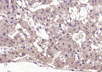 Phospho-HSF1 (Ser303 + Ser307) Rabbit Polyclonal Antibody