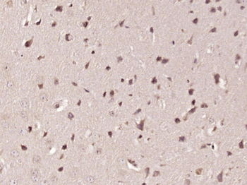 Phospho-HSF1 (Thr142) Rabbit Polyclonal Antibody