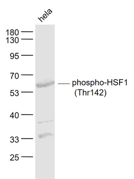 Phospho-HSF1 (Thr142) Rabbit Polyclonal Antibody