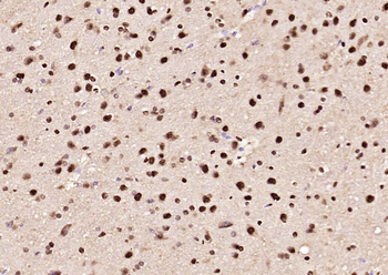 HnRNP D/AUF1 Rabbit Polyclonal Antibody