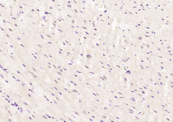 HnRNP M1-M4 Rabbit Polyclonal Antibody