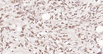 HnRNP M1-M4 Rabbit Polyclonal Antibody