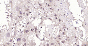 HnRNP M3-M4 Rabbit Polyclonal Antibody