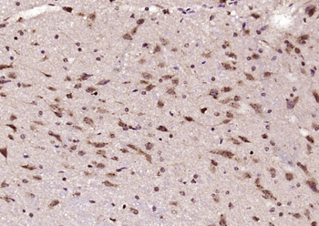 HnRNP Q Rabbit Polyclonal Antibody