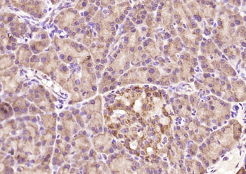 HnRNP Q Rabbit Polyclonal Antibody