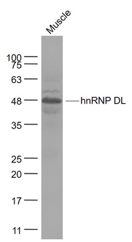 HnRNP DL Rabbit Polyclonal Antibody