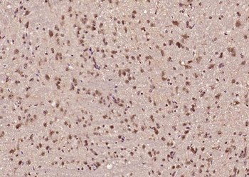 HnRNP H2 Rabbit Polyclonal Antibody