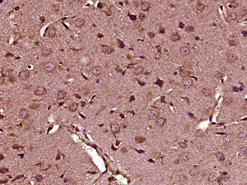 HOGA1 Rabbit Polyclonal Antibody