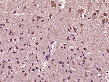 HCFC1R1 Rabbit Polyclonal Antibody