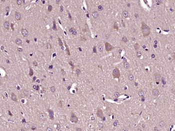 HCFC1R1 Rabbit Polyclonal Antibody