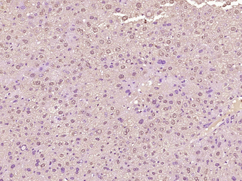 HOXD1 Rabbit Polyclonal Antibody