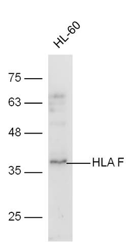 HLA F Rabbit Polyclonal Antibody