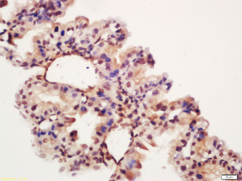 LIN28B Rabbit Polyclonal Antibody