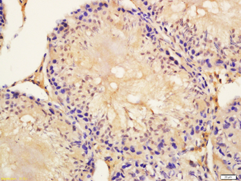 LIN28B Rabbit Polyclonal Antibody