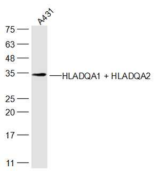 HLADQA1 + HLADQA2 Rabbit Polyclonal Antibody