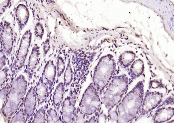 HMGN2/HMG17 Rabbit Polyclonal Antibody