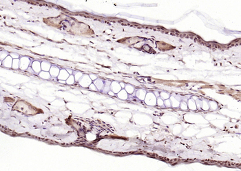 HMGN2/HMG17 Rabbit Polyclonal Antibody