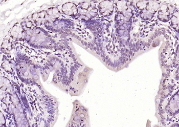 HMGN2/HMG17 Rabbit Polyclonal Antibody