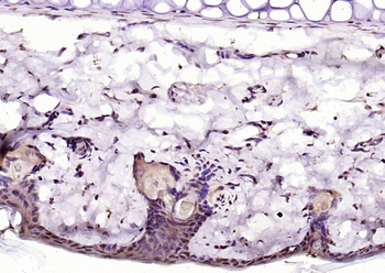 HMGN2/HMG17 Rabbit Polyclonal Antibody