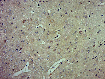 HSPA12A Rabbit Polyclonal Antibody