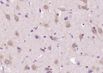 HspBP1 Rabbit Polyclonal Antibody