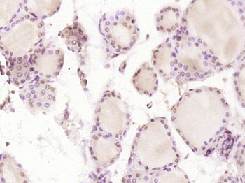 HSPC111 Rabbit Polyclonal Antibody