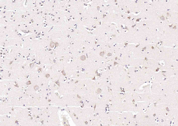 HTRA4 Rabbit Polyclonal Antibody