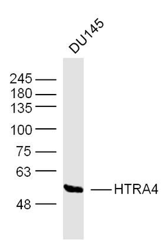 HTRA4 Rabbit Polyclonal Antibody