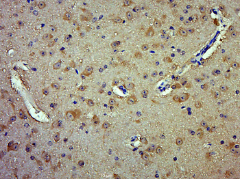 HUPF2/RENT2 Rabbit Polyclonal Antibody