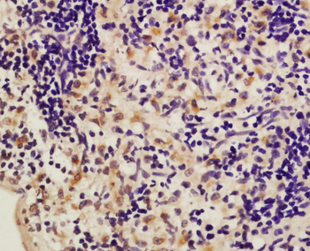 IL-17F Rabbit Polyclonal Antibody