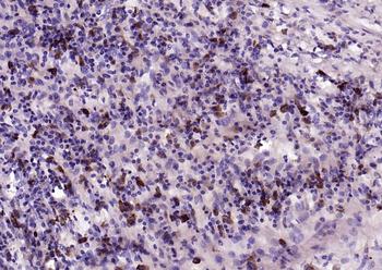 IL-2 Rabbit Polyclonal Antibody