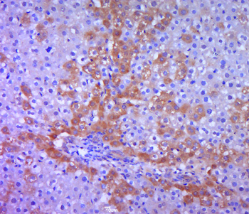 ILF2 Rabbit Polyclonal Antibody