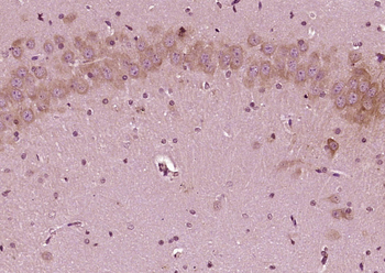 Phospho-Integrin beta 1 (Tyr795) Rabbit Polyclonal Antibody