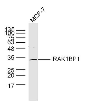 IRAK1BP1 Rabbit Polyclonal Antibody