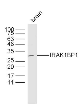 IRAK1BP1 Rabbit Polyclonal Antibody