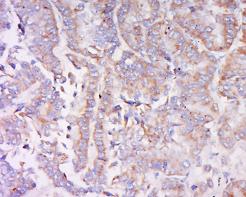 IRAK1BP1 Rabbit Polyclonal Antibody