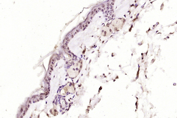 IRAKM Rabbit Polyclonal Antibody