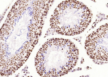 IRF2 Rabbit Polyclonal Antibody