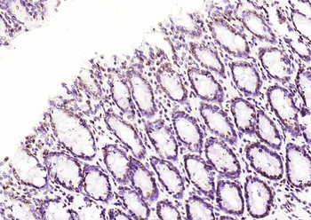 IRF2 Rabbit Polyclonal Antibody