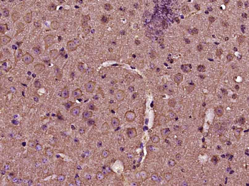 Phospho-IRS1 (Ser616) Rabbit Polyclonal Antibody