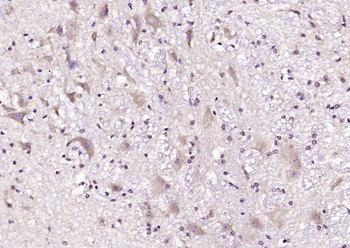 ITPK1 Rabbit Polyclonal Antibody