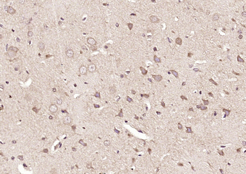 ITPK1 Rabbit Polyclonal Antibody