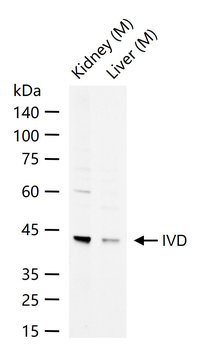 IVD Rabbit Polyclonal Antibody