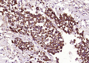 Phospho-BRCA1 (Ser988) Rabbit Polyclonal Antibody