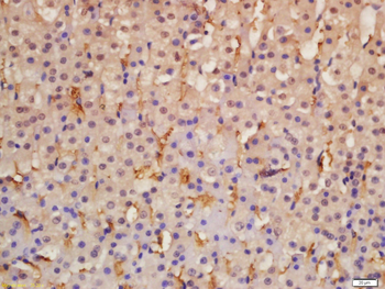 IGFBP4 Rabbit Polyclonal Antibody
